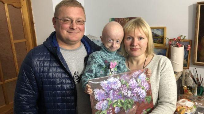 Новини Вінниці - фото з Маленьку вінничанку з синдромом передчасного старіння пролікують в США Маленьку вінничанку з синдромом передчасного старіння пролікують в США, фото №1 на сайті 20minut.ua
