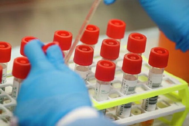 Новини Вінниці - фото з Важливе за вчора. Найцікавіші новини 23 травня, які ви могли пропустити На Вінниччині виявили 853 випадки коронавірусу: дані по Вінниці та районах