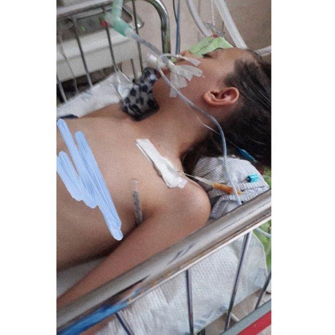 Новини Вінниці - фото з Знаходиться у важкому стані: 10-річна вінничанка захворіла на правець Знаходиться у важкому стані: 10-річна вінничанка захворіла на правець, фото №1 на сайті 20minut.ua