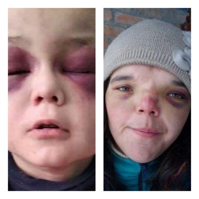 Важливе за вихідні: ТОП новин для козятинчан, фото №4 на сайті 20minut.ua