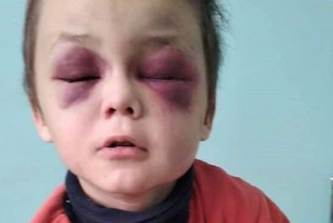 Новини Вінниці - фото з Побиття маленького Вані з Козятинщини: мачуха отримала остаточний вирок Мачуха Людмила отримала два роки тюрми за катування 6-річного Вані