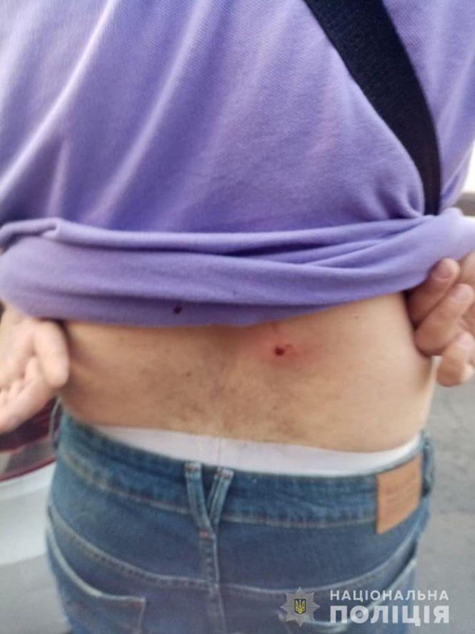 Новини Вінниці - фото з Стрілянина на Дубовецькій: батько та син поранили чоловіка, який доставляв піцу Стрілянина на Дубовецькій: батько та син поранили чоловіка, який доставляв піцу, фото №2 на сайті 20minut.ua