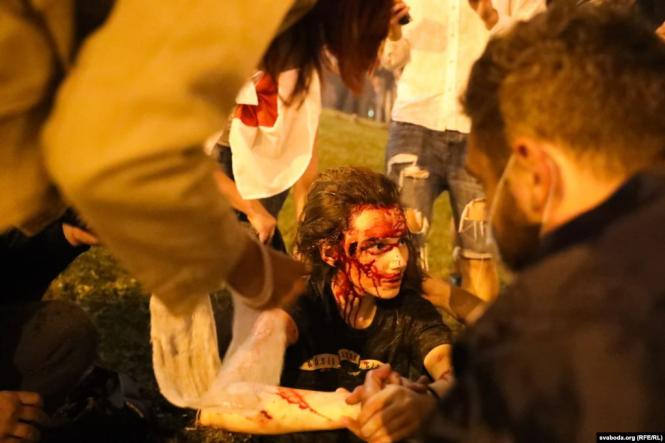 Новини Хмельницького - фото з Протести в Білорусі: що відбувається та як ви до цього ставитеся? (ОПИТУВАННЯ) Протести також відбувалися на перехресті проспекту Машерова і вулиці Тімірязєва. Там під час розгону були поранені кілька людей. У Мінській міській клінічній лікарні швидкої медичної допомоги відмовилися коментувати виклики на проспекти Переможців і Машерова, а також говорити що-небудь про постраждалих