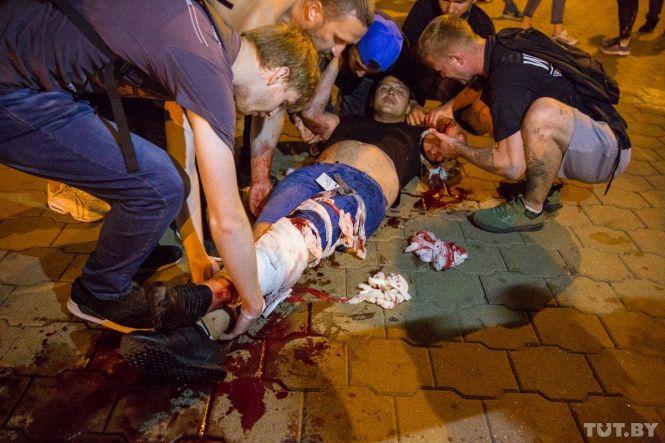 Новини Хмельницького - фото з Протести в Білорусі: що відбувається та як ви до цього ставитеся? (ОПИТУВАННЯ) Протести в Білорусі: що відбувається та як ви до цього ставитеся? (ОПИТУВАННЯ), фото №15 на сайті vsim.ua