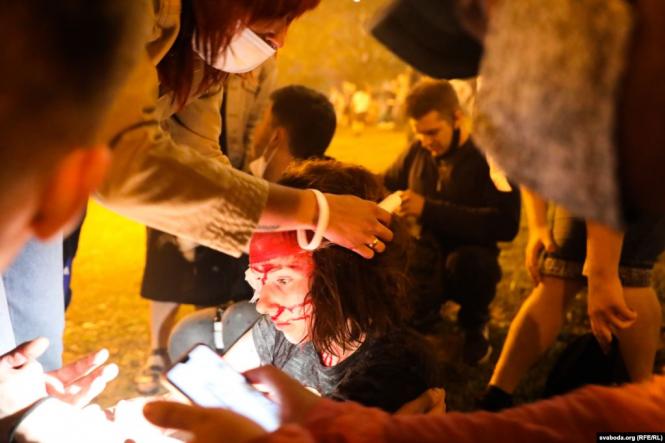 Новини Хмельницького - фото з Протести в Білорусі: що відбувається та як ви до цього ставитеся? (ОПИТУВАННЯ) За повідомленнями деяких ЗМІ, натовп протестувальників на вулиці Немига в центрі Мінська протаранив автозак: постраждали щонайменше дві людини (одна людина була у важкому стані). Правозахисний центр «Весна» повідомив, що в ніч на 10 серпня чоловік зазнав черепно-мозкової травми, несумісної з життям, після наїзду спецтехніки на проспекті Переможців