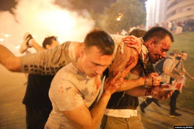 Новини Хмельницького - фото з Протести в Білорусі: що відбувається та як ви до цього ставитеся? (ОПИТУВАННЯ) У Мінську зіткнення ОМОНу з протестувальниками почалися біля стели на проспекті Переможців. Там силовики використовували світлошумові гранати і сльозогінний газ, а також пригнали в цей район водомет