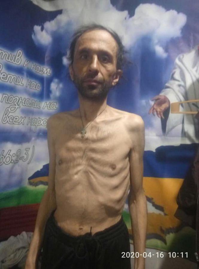 Дива не закінчуються: історія про колишнього безхатченка Євгена, який живе без шлунку, фото №1 на сайті 20minut.ua