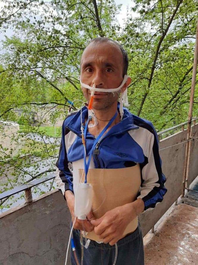 Дива не закінчуються: історія про колишнього безхатченка Євгена, який живе без шлунку, фото №3 на сайті 20minut.ua