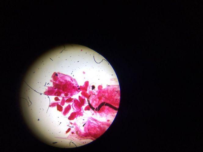 Глянути на світ у деталях. Що можна побачити на унікальній виставці з мікроскопами у Вінниці, фото №2 на сайті 20minut.ua