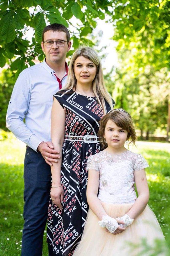 Отримав серйозні травми й пережив 11 операцій: історія заробітчанина з Волочиська, фото №1 на сайті vsim.ua