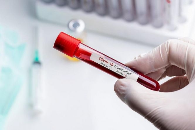 Дві смерті та 66 нових хворих. Дані про COVID-19 по Вінниці та районах