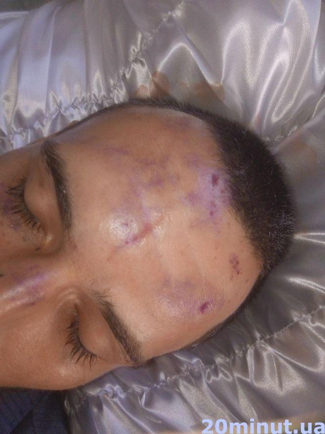 Новини Вінниці - фото з Загадкова смерть 27-річного Євгена у Жмеринці. Хлопця знайшли повішеним на зупинці Загадкова смерть 27-річного Євгена у Жмеринці. Хлопця знайшли повішеним на зупинці, фото №13 на сайті 20minut.ua