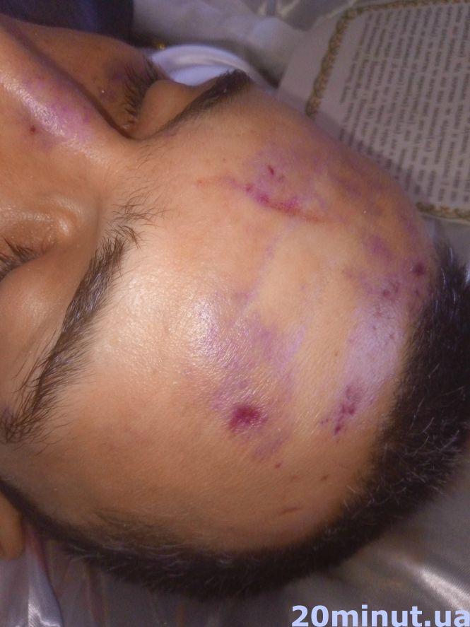 Загадкова смерть 27-річного Євгена у Жмеринці. Хлопця знайшли повішеним на зупинці, фото №16 на сайті 20minut.ua