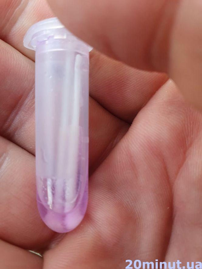 Ми пройшли ПЛР-тестування у трьох лабораторіях Тернополя. Який результат? ЕКСКЛЮЗИВ "20 хвилин", фото №4 на сайті 20minut.ua