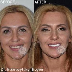 Новини Хмельницького - фото з Сучасна стоматологія - новітні технології (Новини компаній) Сучасна стоматологія - новітні технології (Новини компаній), фото №2 на сайті vsim.ua