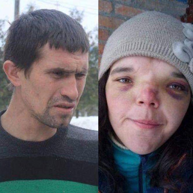 Днями хлопчик переніс клінічну смерть.  Який стан Іванка та Іванни після ДТП під Турбовом?, фото №3 на сайті 20minut.ua