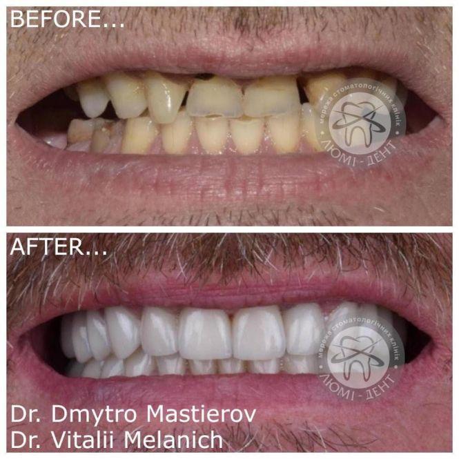 Новини Хмельницького - фото з Сучасна стоматологія - новітні технології (Новини компаній) Сучасна стоматологія - новітні технології (Новини компаній), фото №1 на сайті vsim.ua