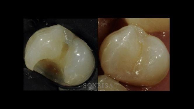 Новини Тернополя - фото з З турботою та гарантією на 10 років. Подбайте про свою красиву посмішку у клініці "Sonrisa" (новини компаній) З турботою та гарантією на 10 років. Подбайте про свою красиву посмішку у клініці "Sonrisa" (новини компаній), фото №2 на сайті 20minut.ua