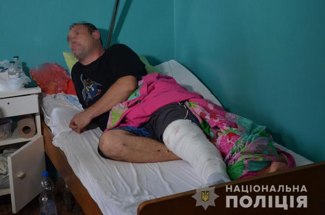 У лісі на Радомишльщині киянин умисно поранив з рушниці місцевого грибника, фото №5 на сайті 20minut.ua