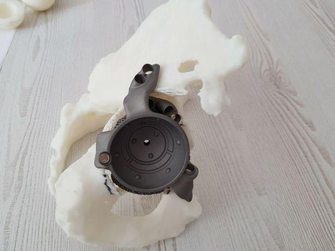 Новини Вінниці - фото з Лабораторії 3D-друку та біомедичної інженерії створюють персоналізовані імплантати (Новини компаній) Лабораторії 3D-друку та біомедичної інженерії створюють персоналізовані імплантати (Новини компаній), фото №3 на сайті 20minut.ua