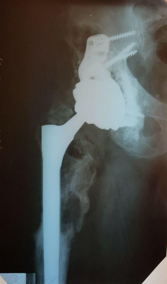 Новини Вінниці - фото з Лабораторії 3D-друку та біомедичної інженерії створюють персоналізовані імплантати (Новини компаній) Лабораторії 3D-друку та біомедичної інженерії створюють персоналізовані імплантати (Новини компаній), фото №2 на сайті 20minut.ua