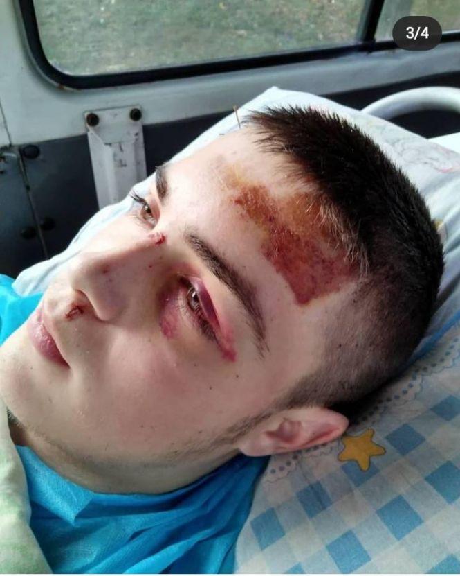 Новини Вінниці - фото з «Перед цим його побили»: що з хлопцем, якого нещодавно переїхав потяг під Козятином «Перед цим його побили»: що з хлопцем, якого нещодавно переїхав потяг під Козятином, фото №2 на сайті 20minut.ua