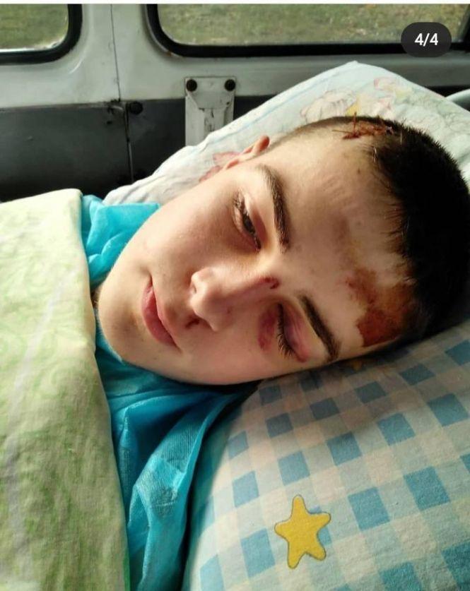 Новини Вінниці - фото з «Перед цим його побили»: що з хлопцем, якого нещодавно переїхав потяг під Козятином «Перед цим його побили»: що з хлопцем, якого нещодавно переїхав потяг під Козятином, фото №1 на сайті 20minut.ua