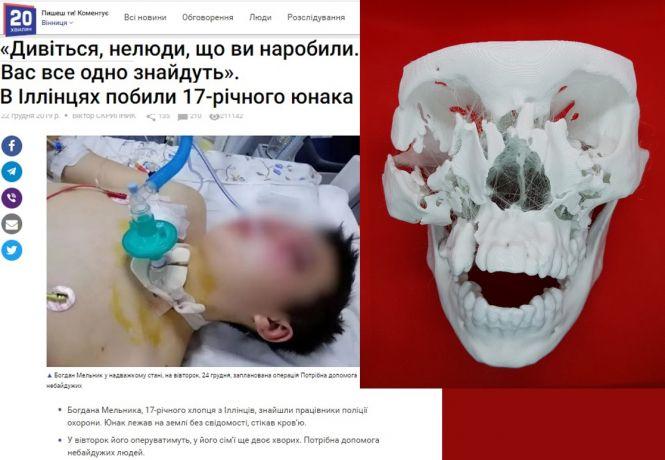 Новини Вінниці - фото з Лабораторії 3D-друку та біомедичної інженерії створюють персоналізовані імплантати (Новини компаній) Лабораторії 3D-друку та біомедичної інженерії створюють персоналізовані імплантати (Новини компаній), фото №4 на сайті 20minut.ua