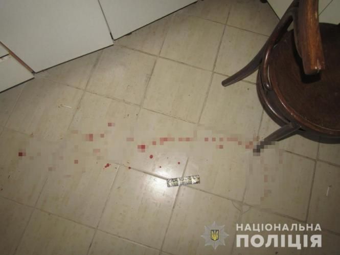 На Малинщині чоловік побив колишню дружину: поліція кваліфікує це як замах на вбивство, фото №1 на сайті 20minut.ua