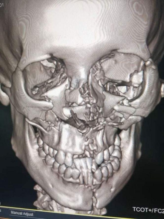 Терміново! Житомирянка потрапила в ДТП, потрібна допомога, фото №1 на сайті 20minut.ua