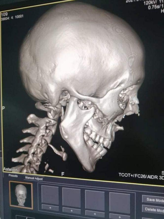 Терміново! Житомирянка потрапила в ДТП, потрібна допомога, фото №2 на сайті 20minut.ua