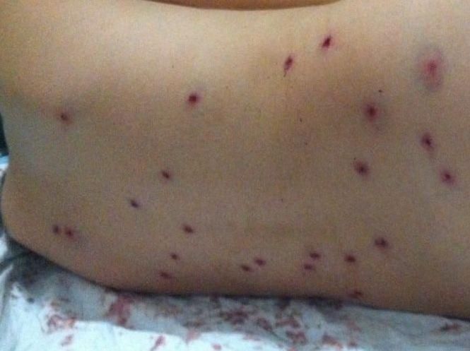 Новини Тернополя - фото з "Він розуміє, що трапилося": як почувається Максим, якого підстрелили на гірці. Що загрожує його кривднику? "Він розуміє, що трапилося": як почувається Максим, якого підстрелили на гірці. Що загрожує його кривднику?, фото №3 на сайті 20minut.ua