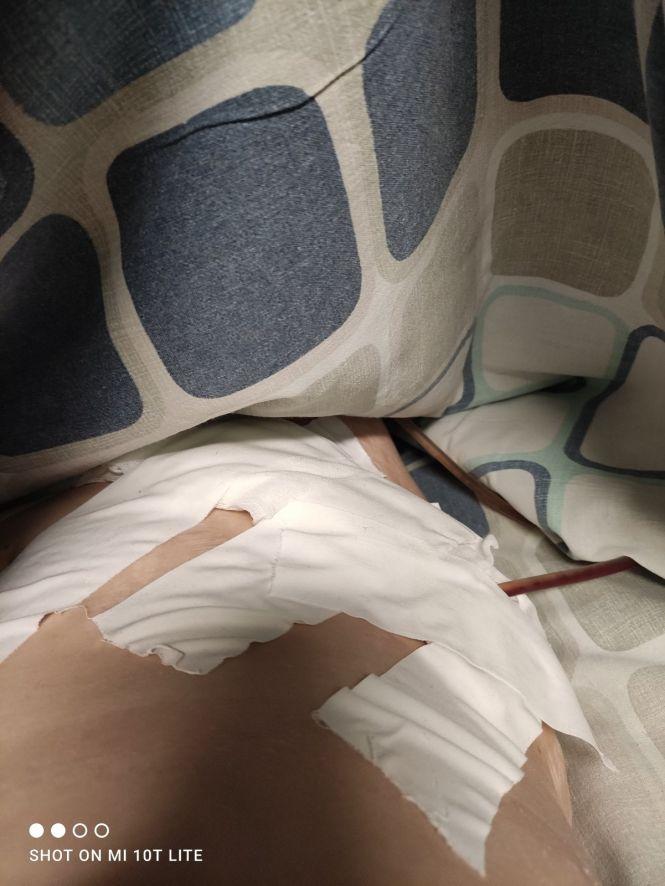 Новини Тернополя - фото з "Я майже живчик..." 20-річний Ігор з Шумська розповів, як йому безкоштовно пересадили нирку "Я майже живчик..." 20-річний Ігор з Шумська розповів, як йому безкоштовно пересадили нирку, фото №6 на сайті 20minut.ua