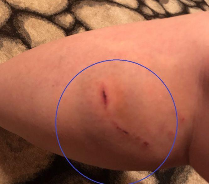 "Рятуйте, мене вкусив собака!" Чи реально знайти вакцину від сказу в Тернополі – ми перевірили, фото №3 на сайті 20minut.ua