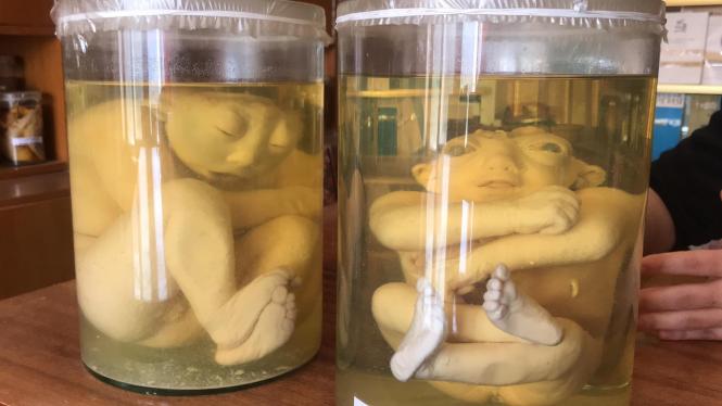 Новини Хмельницького - фото з Морг у Хмельницькому. Як влаштований і що там показали журналістам ВСІМ Нет описания.