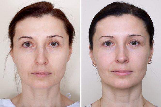 Новини Вінниці - фото з Корекція грудей, статевих органів, відновлення цноти. Які види тюнінгу найпопулярніші серед вінничан? Корекція грудей, статевих органів, відновлення цноти. Які види тюнінгу найпопулярніші серед вінничан?, фото №4 на сайті 20minut.ua