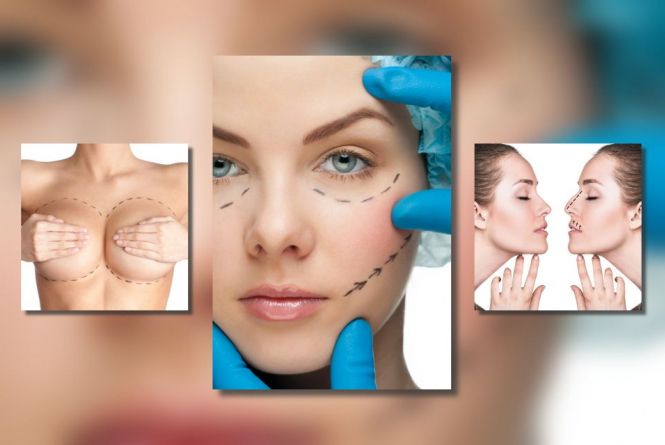 Корекція грудей, статевих органів, відновлення цноти. Які види тюнінгу найпопулярніші серед вінничан?