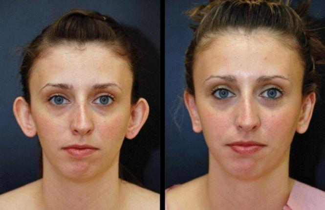 Новини Вінниці - фото з Корекція грудей, статевих органів, відновлення цноти. Які види тюнінгу найпопулярніші серед вінничан? Корекція грудей, статевих органів, відновлення цноти. Які види тюнінгу найпопулярніші серед вінничан?, фото №5 на сайті 20minut.ua