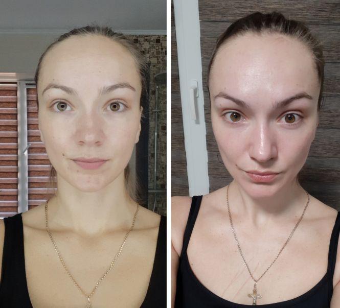 Фейсбілдінг VS ботокс? Про переваги гімнастики для обличчя розповідає тренер Вікторія Козак, фото №3 на сайті 20minut.ua