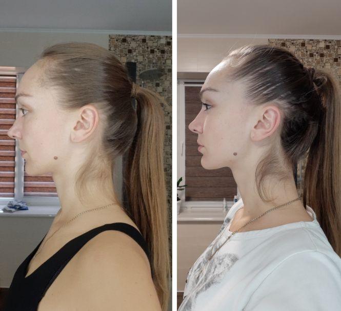 Фейсбілдінг VS ботокс? Про переваги гімнастики для обличчя розповідає тренер Вікторія Козак, фото №6 на сайті 20minut.ua