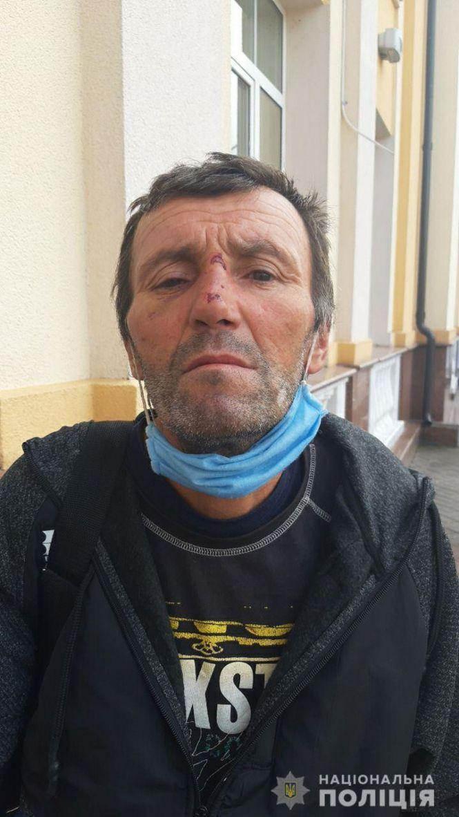 Новини Козятина - фото з Розшукують Олександра Чупонова. Чоловіка підозрюють у крадіжці