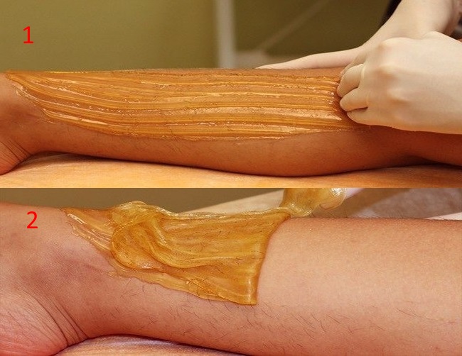 Новини Тернополя - фото з Видалення небажаного волосся в Тернополі: скільки коштує та де ефективно. А що ви обираєте? Делаем ваксинг ног правильно