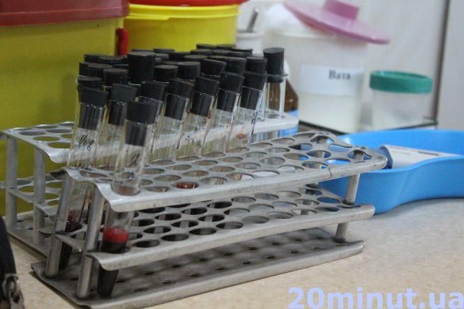 Новини Тернополя - фото з Чи варто насправді витрачати гроші на ІФА-тести? Коментують тернопільські інфекціоністи