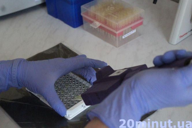 Новини Тернополя - фото з Чи варто насправді витрачати гроші на ІФА-тести? Коментують тернопільські інфекціоністи