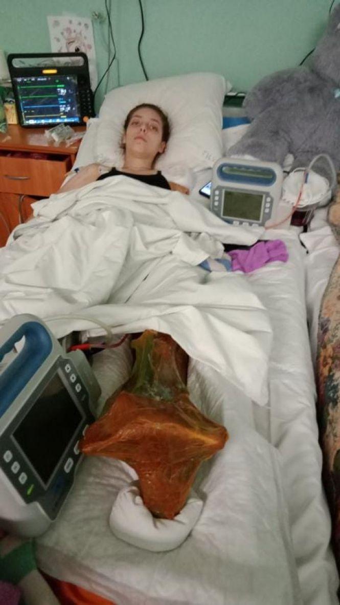 Новини Козятина - фото з Діані Цимбарович почали робити пластику ноги. Дівчина вже може сидіти