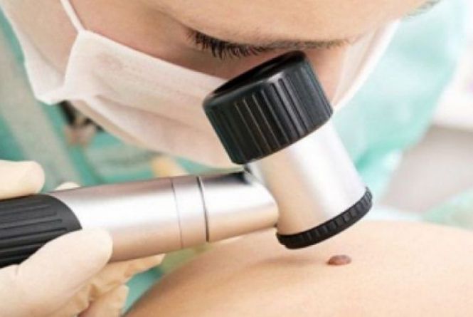 Новини Вінниці - фото з Наслідки пожежі на Бевза, ціни на нерухомість та інше важливе за 1 травня на 20minut.ua Онколог Ігор Феджага: меланома виліковна, якщо діагноз встановили вчасно