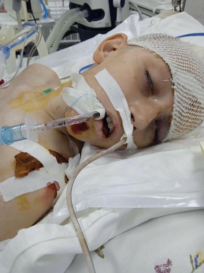 Новини Вінниці - фото з Хлопчику, якого збили на Барському шосе на очах у мами, необхідна наша допомога