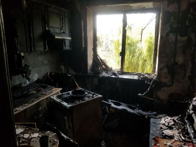 Новини Житомира - фото з Літня коростенка самотужки намагалася загасити вогонь на власній кухні і отримала опіки