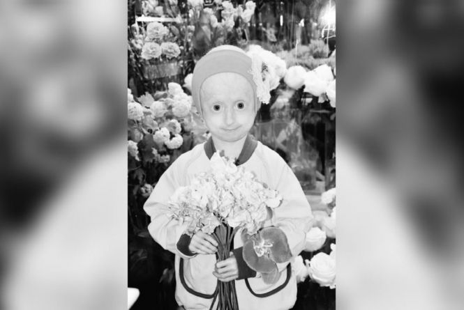 Новини Вінниці - фото з Негода суне на область та нові зміни для вінничан: важливе за 1 липня на 20minut.ua Перестало битися серце маленької вінничанки Іринки Химич