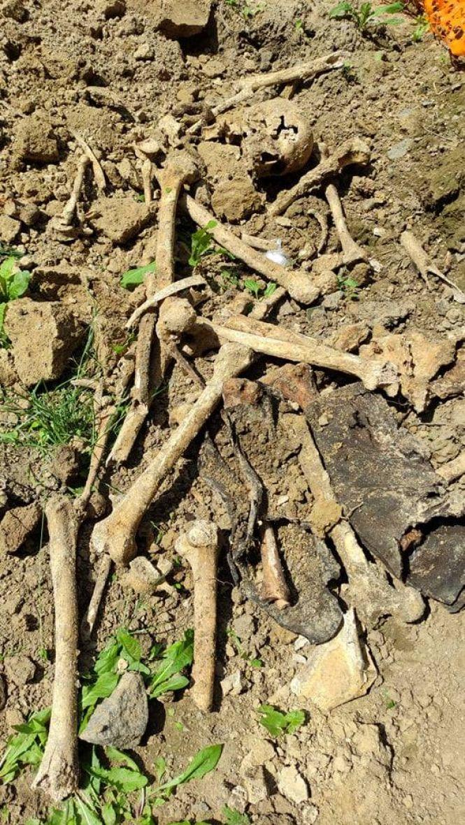 Новини Вінниці - фото з Копали під кабель, знайшли кістки. Біля нічного клубу «Курсаль» робітники розкопали поховання